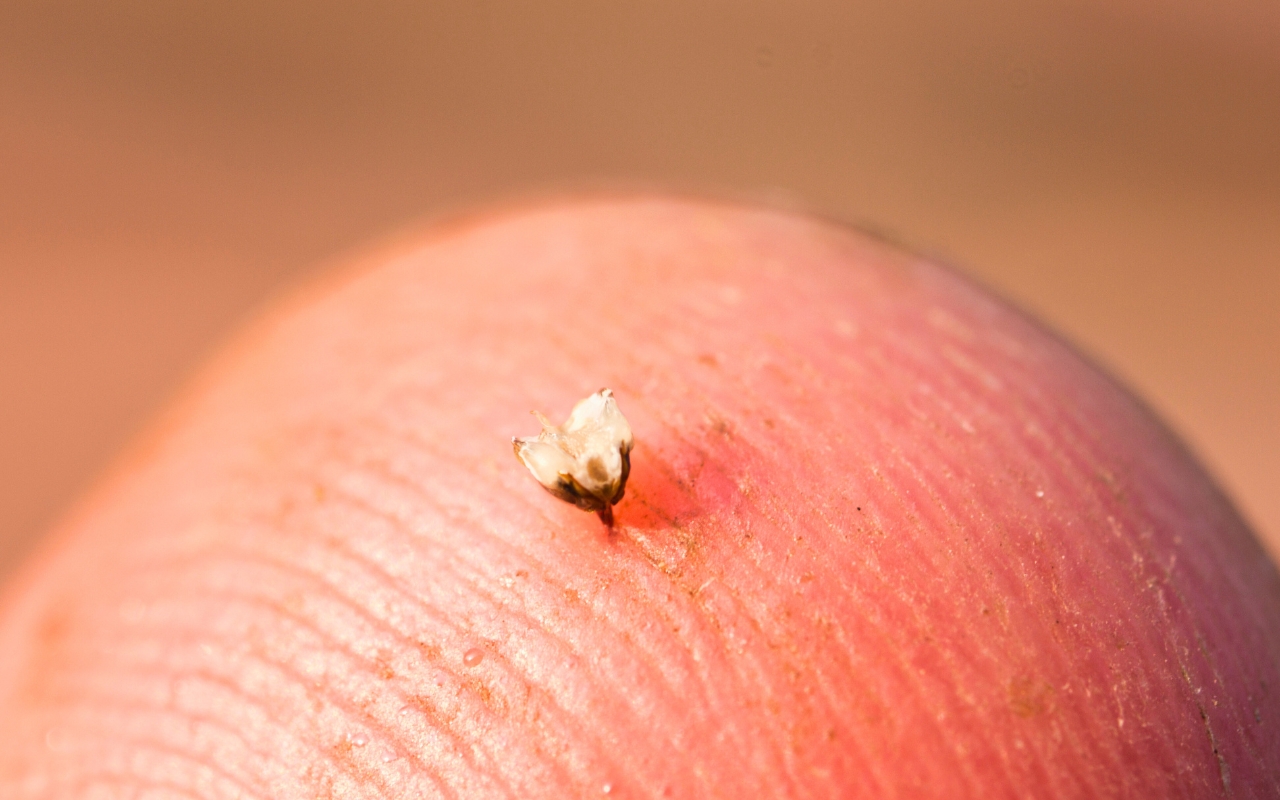 Bienenstachel im Finger